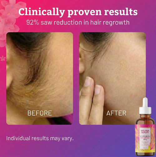 Cyperus Rotundus Hair Removal Oil